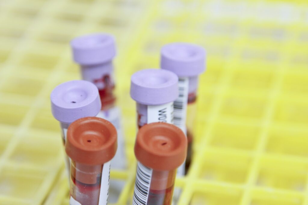 health-checkup-featured
